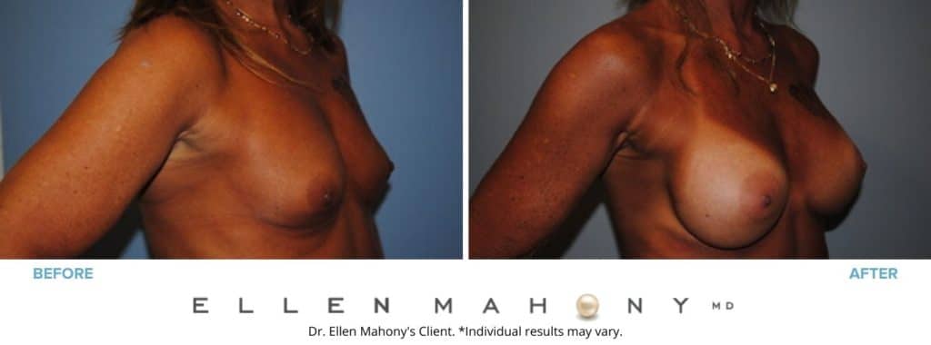 Before and After Image: Case #2833 - right-front-oblique