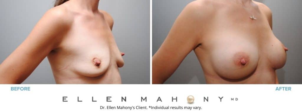 Before and After Image: Case #2875 - right-front-oblique