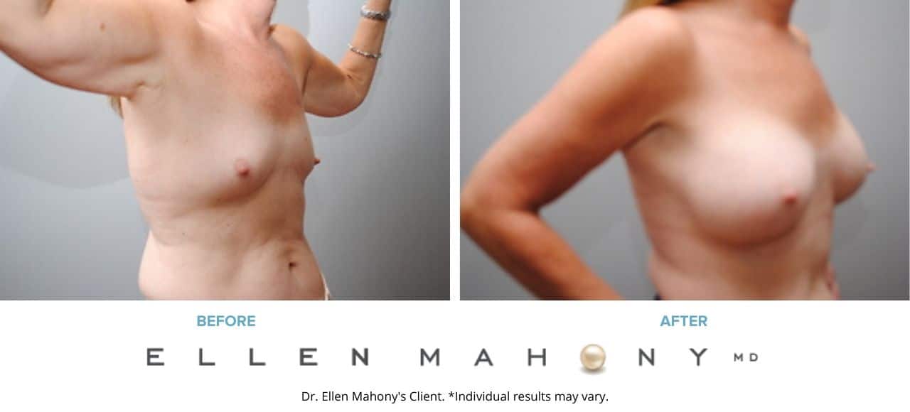 Before and After Image: Case #2882 - right-front-oblique