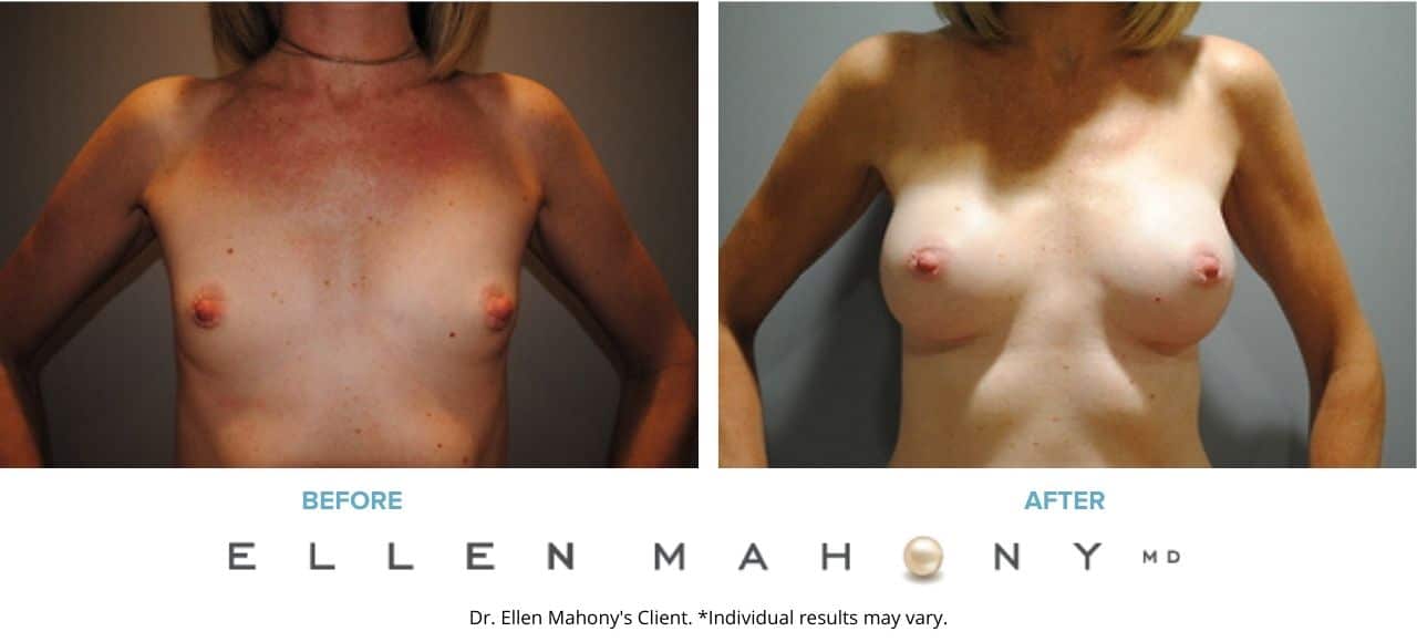 Before and After Image: Case #2898 - front