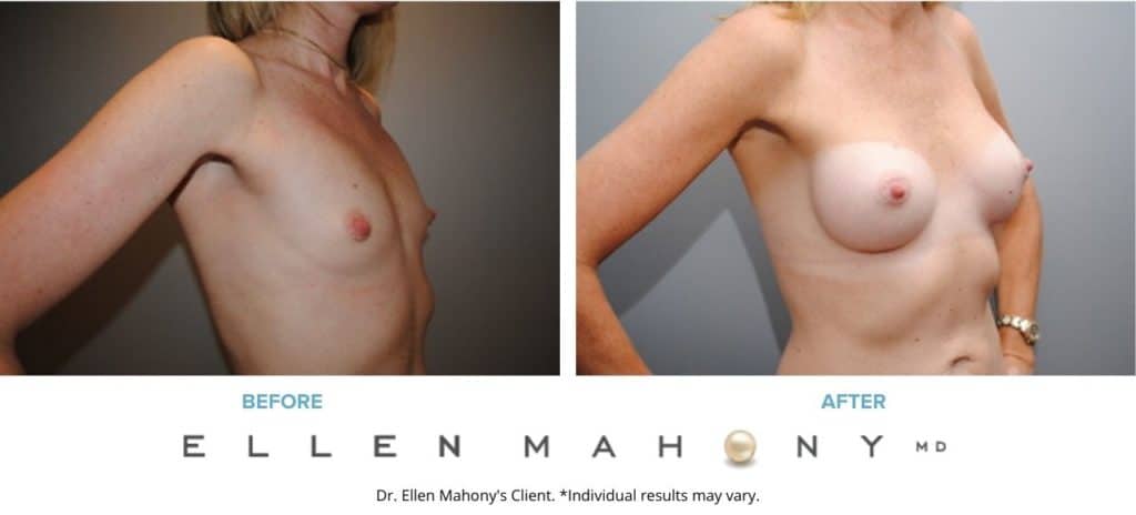 Before and After Image: Case #2898 - right-front-oblique