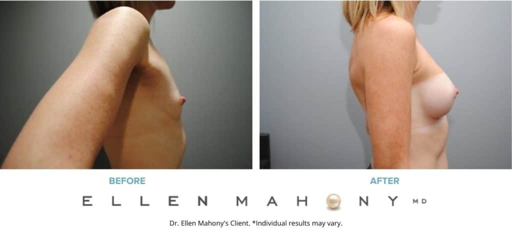 Before and After Image: Case #2898 - right-side
