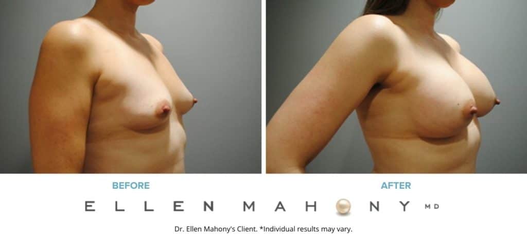 Before and After Image: Case #2905 - right-front-oblique
