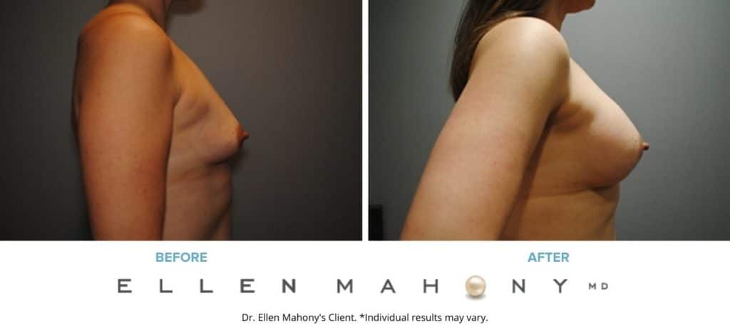 Before and After Image: Case #2905 - right-side