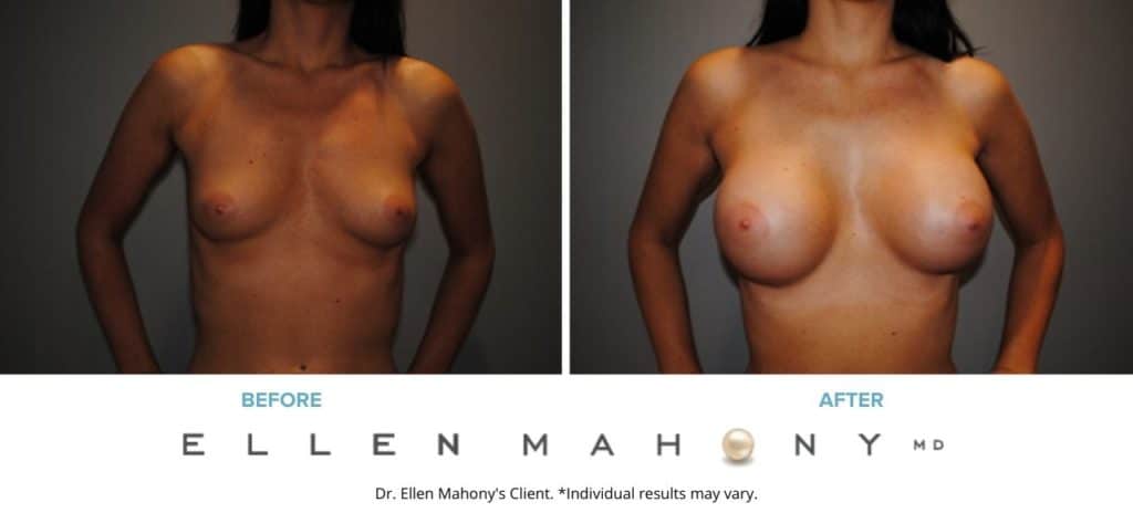 Before and After Image: Case #2925 - front
