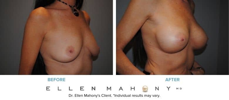 Before and After Image: Case #2936 - right-front-oblique