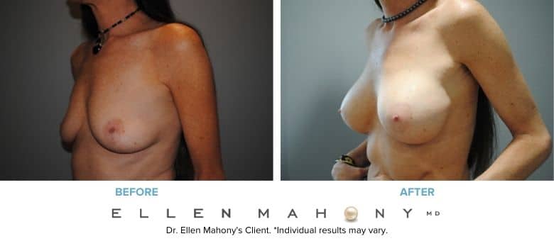 Before and After Image: Case #2936 - left-front-oblique