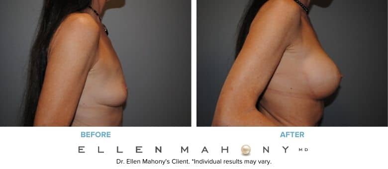 Before and After Image: Case #2936 - right-side