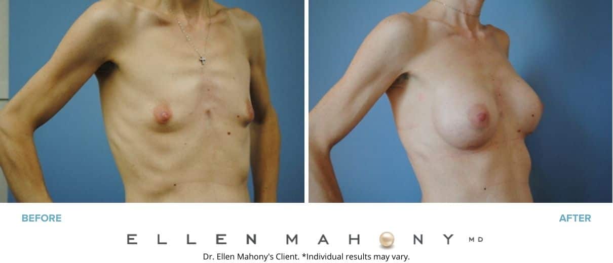 Before and After Image: Case #2977 - right-front-oblique