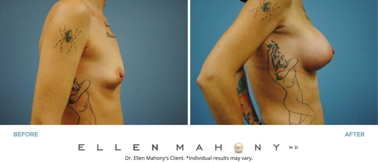 Before and After Image: Case #2988 - right-side