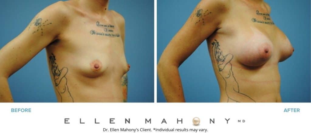 Before and After Image: Case #2988 - right-front-oblique