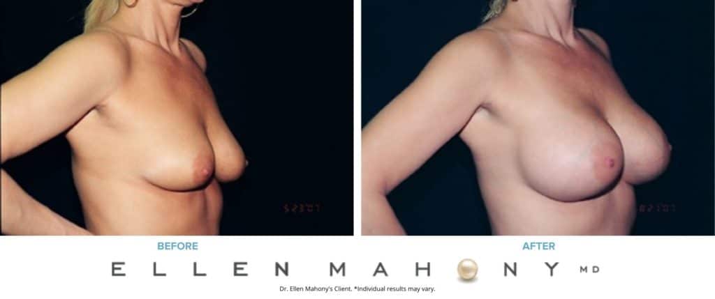 Before and After Image: Case #3076 - right-front-oblique
