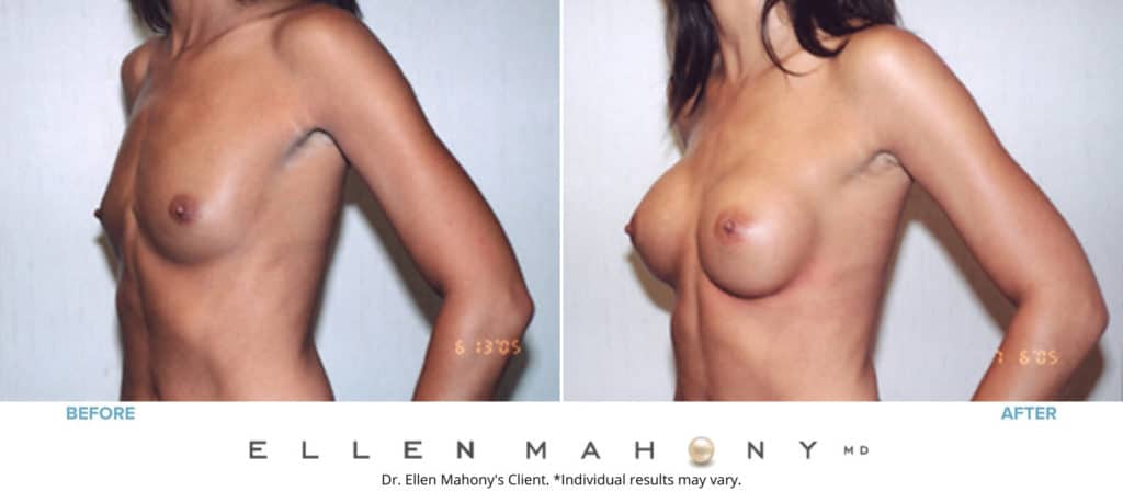 Before and After Image: Case #3097 - left-front-oblique