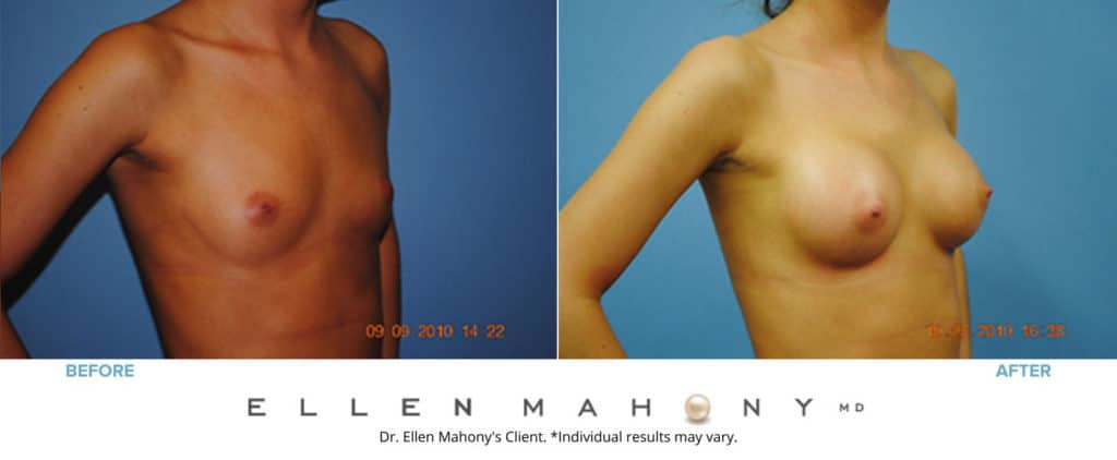 Before and After Image: Case #3102 - right-front-oblique