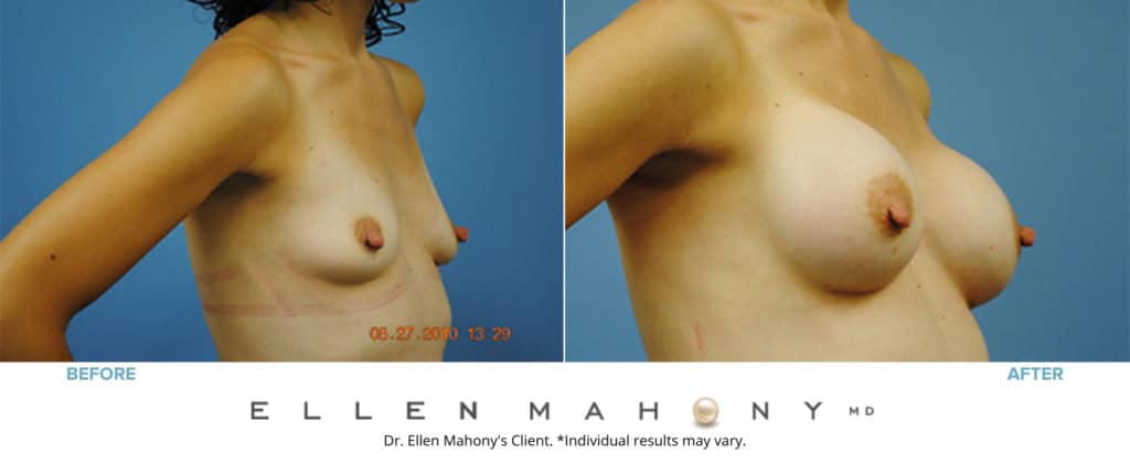Before and After Image: Case #3116 - right-front-oblique