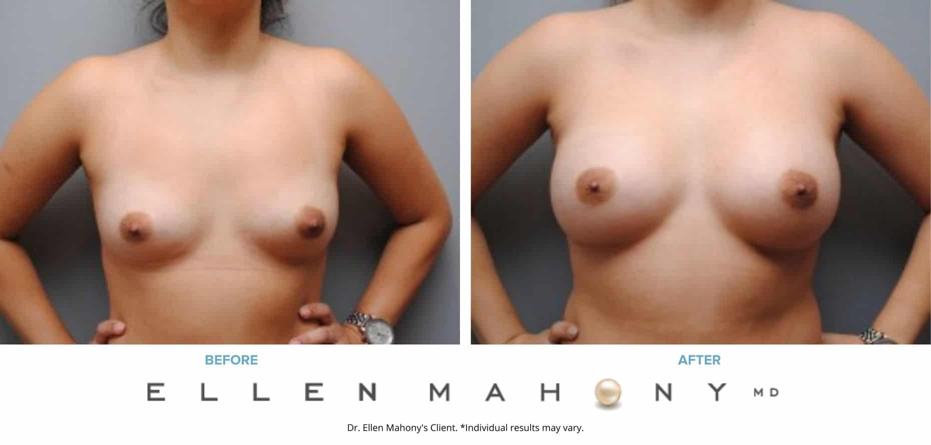 Before and After Image: Case #4806 - front