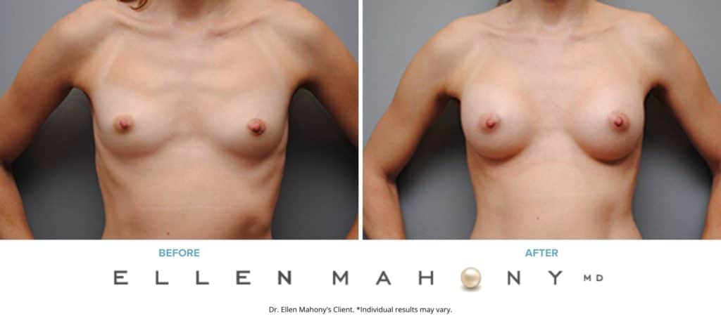 Before and After Image: Case #4937 - front
