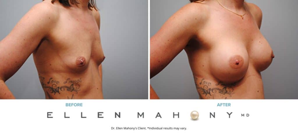 Before and After Image: Case #5011 - right-front-oblique
