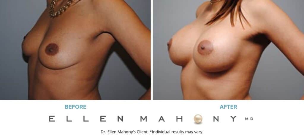 Before and After Image: Case #5078 - left-front-oblique