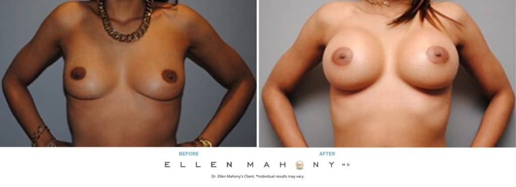 Before and After Image: Case #5078 - front