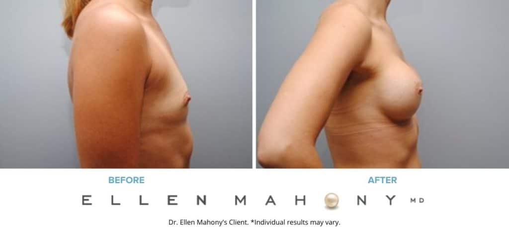 Before and After Image: Case #5086 - right-side