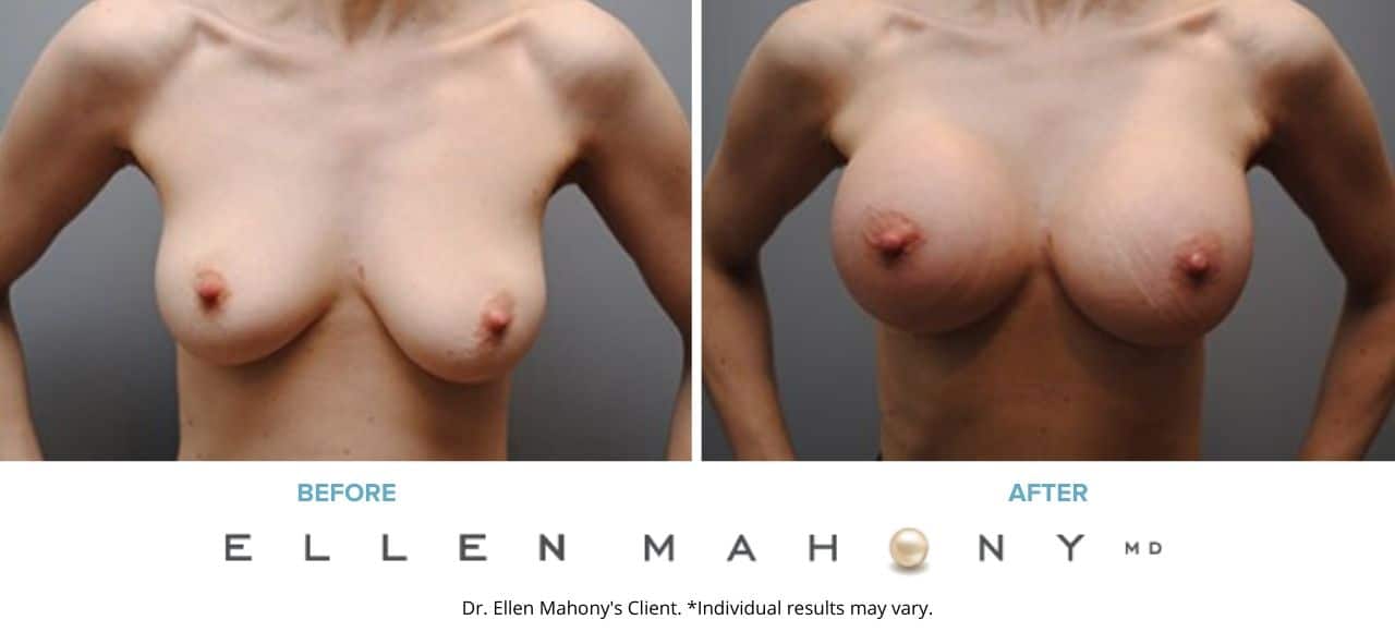 Before and After Image: Case #5094 - front