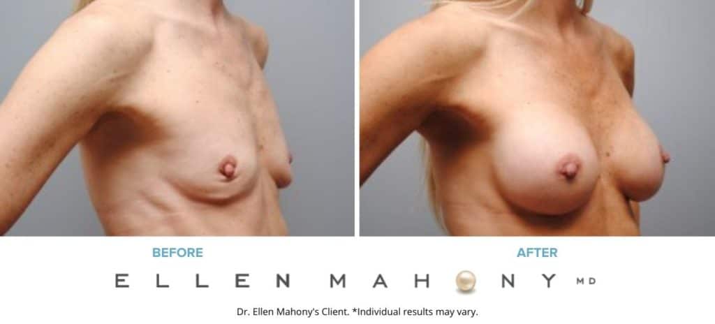 Before and After Image: Case #5395 - right-front-oblique