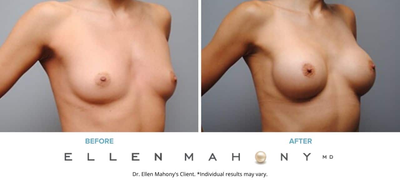 Before and After Image: Case #5405 - right-front-oblique