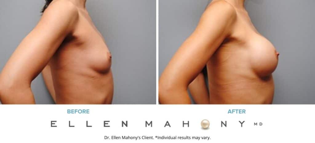 Before and After Image: Case #5405 - right-side