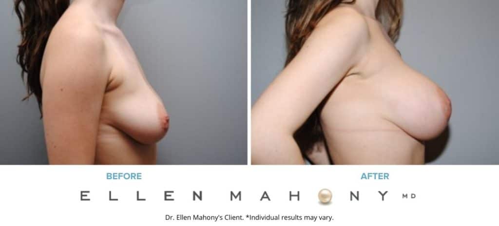 Before and After Image: Case #5491 - right-side