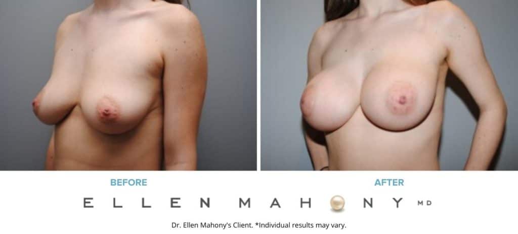Before and After Image: Case #5491 - left-front-oblique