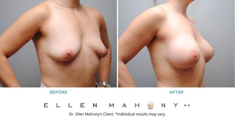 Before and After Image: Case#5512 - right-front-oblique