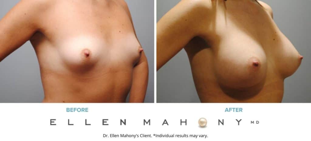 Before and After Image: Case #6103 - right-front-oblique