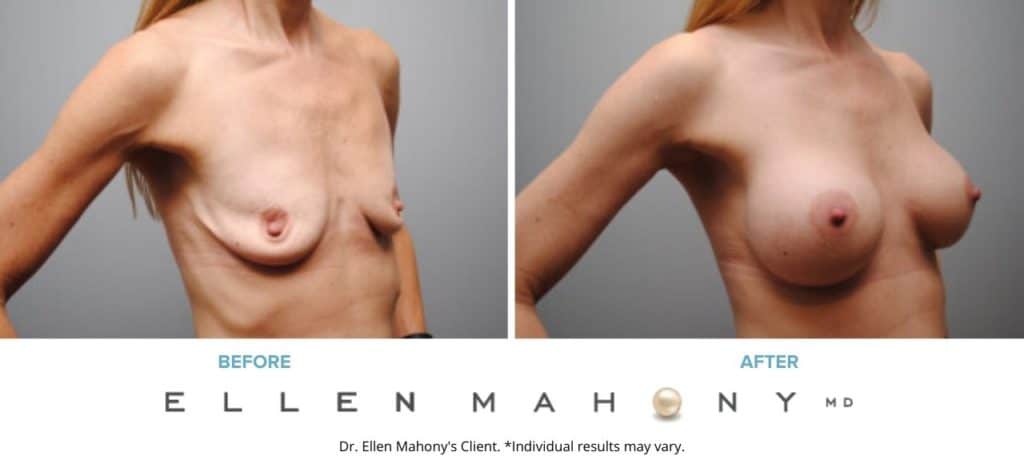 Before and After Image: Case #6287 - right-front-oblique