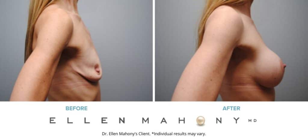 Before and After Image: Case #6287 - right-side