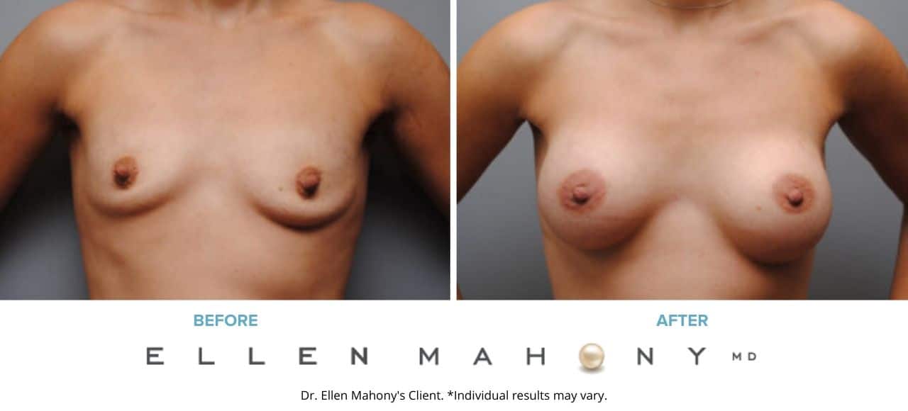 Before and After Image: Case #6297 - front