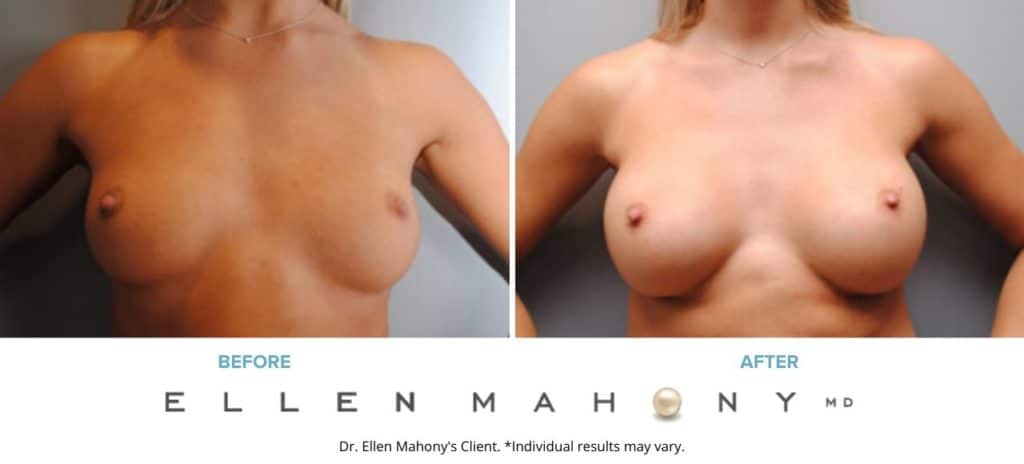 Before and After Image: Case #6440 - front