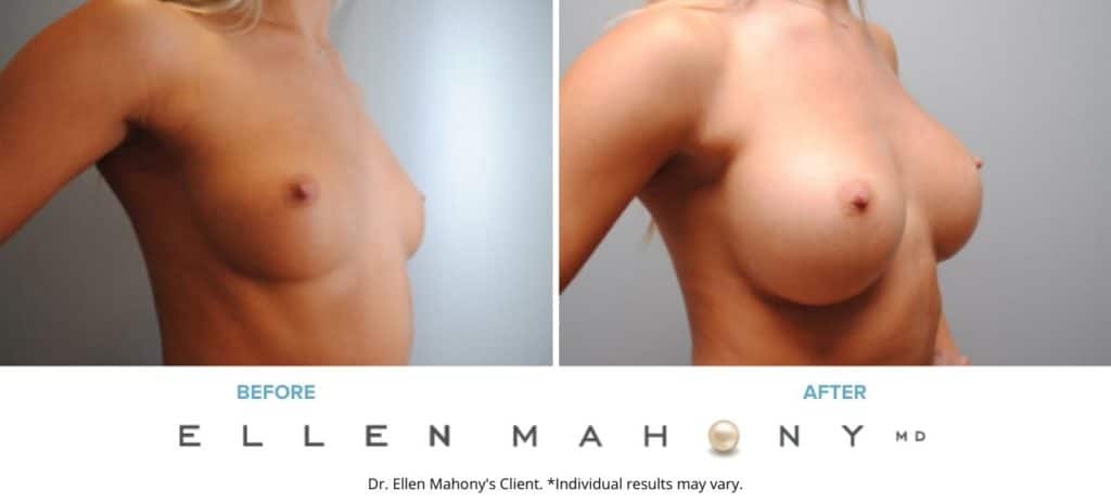 Before and After Image: Case #6440 - right-front-oblique