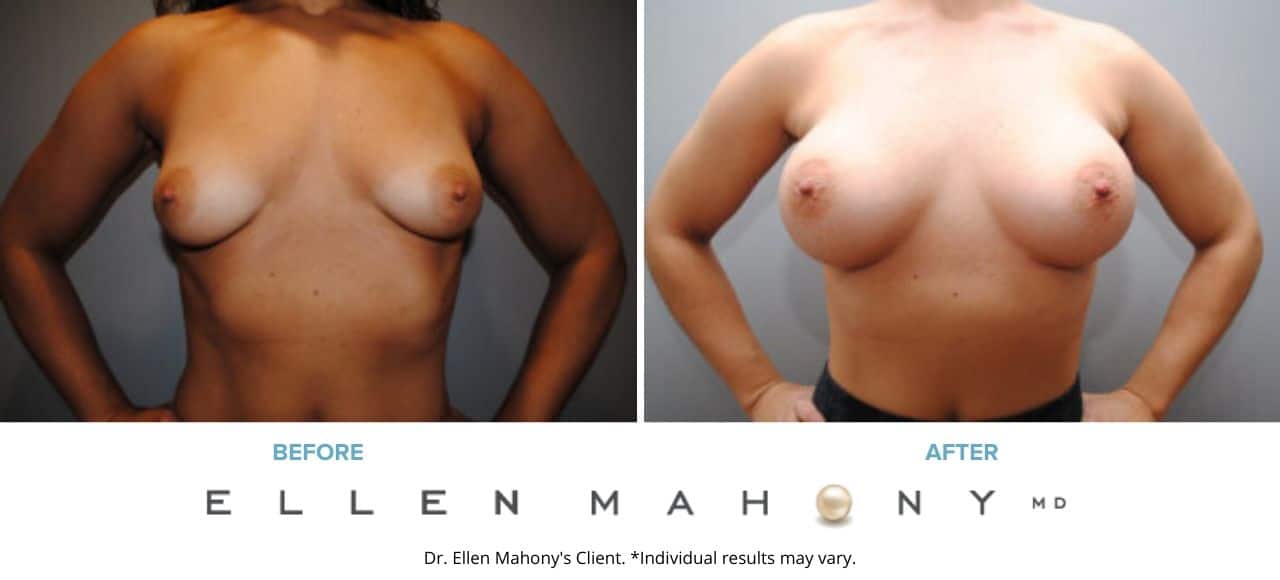 Before and After Image: Case #6457 - front