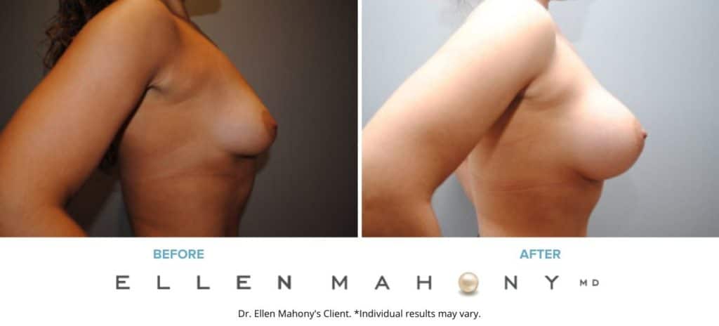 Before and After Image: Case #6457 - right-side