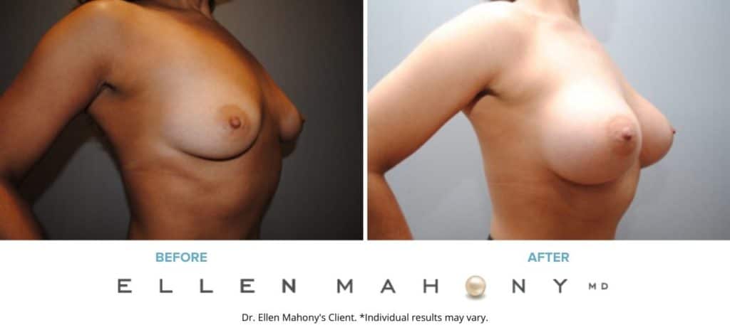 Before and After Image: Case #6457 - right-front-oblique