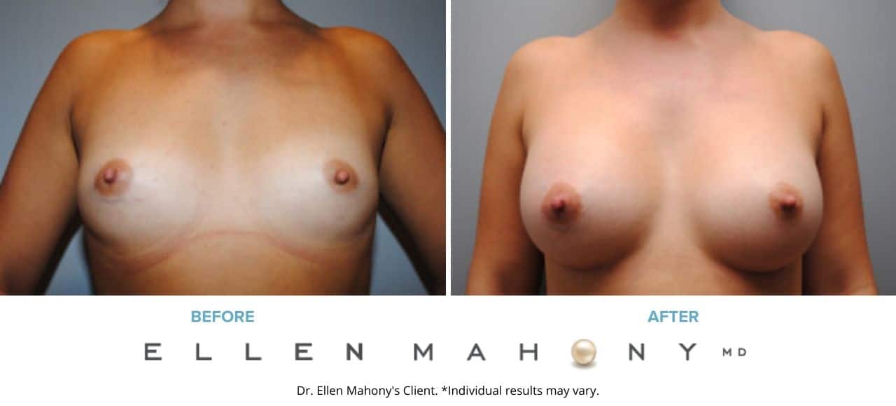 Before and After Image: Case #6473 - front