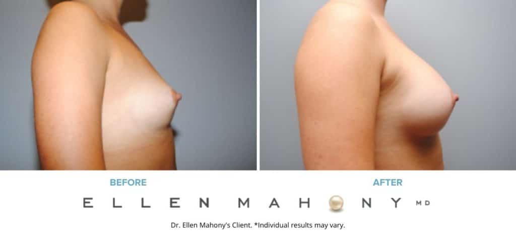 Before and After Image: Case #6473 - right-side