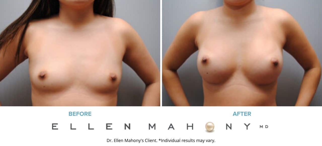 Before and After Image: Case #6491 - front