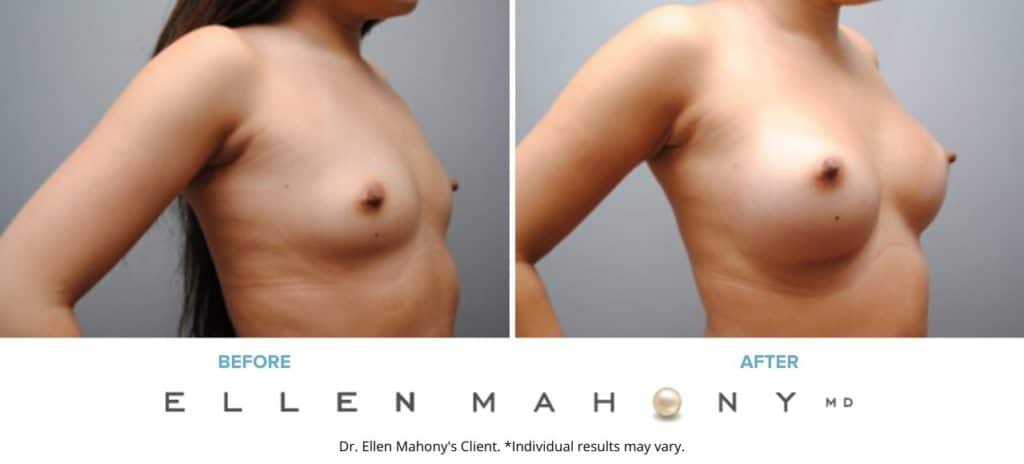 Before and After Image: Case #6491 - right-front-oblique
