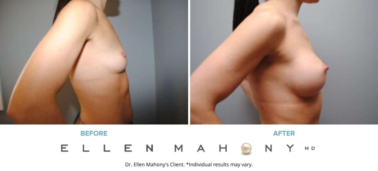 Before and After Image: Case #6508 - right-side