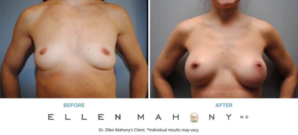 Before and After Image: Case #6508 - front
