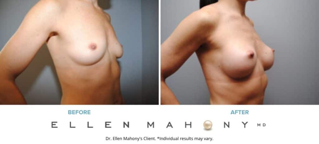 Before and After Image: Case #6508 - right-front-oblique