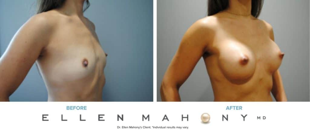 Before and After Image: Case #6920 - right-front-oblique