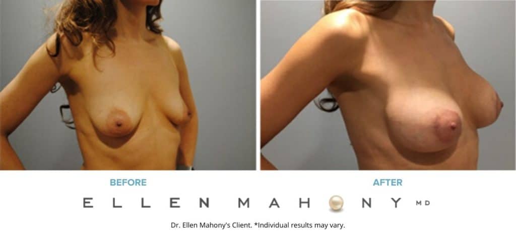 Before and After Image: Case #7206 - right-front-oblique